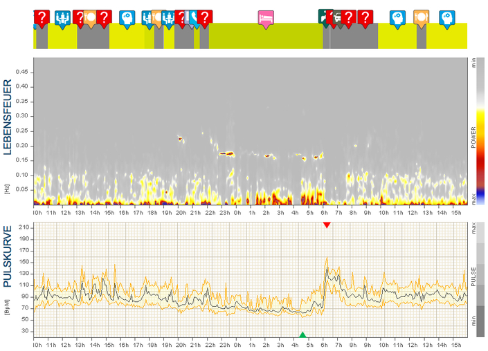 Chronischer Stress